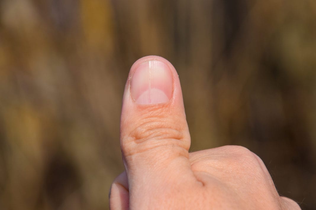 Por qué aparecen las estrías en las uñas y cómo prevenirlas